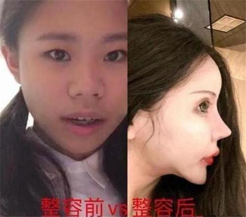 整容男网红吃瓜事件真相,真相背后令人震惊